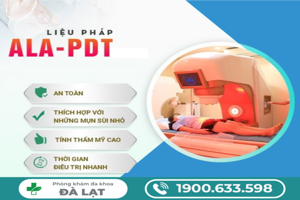 Hình ảnh minh họa